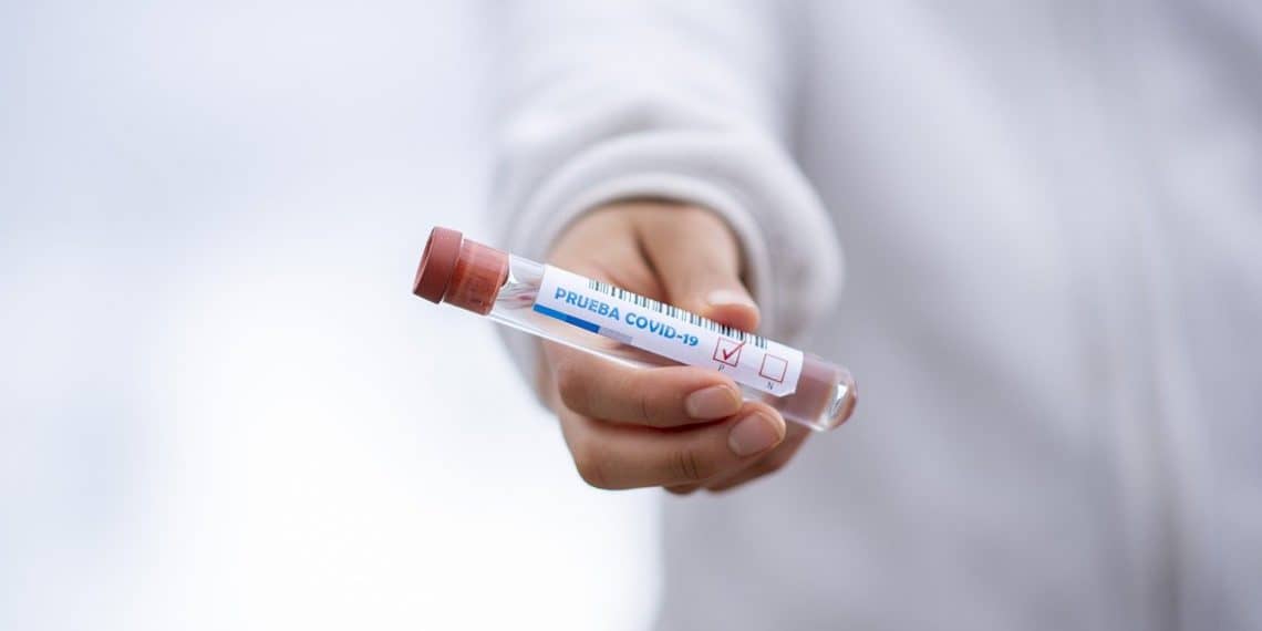 Coronavirus: La cantidad de hisopados en Cutral Co y Huincul es menor a la recomendada