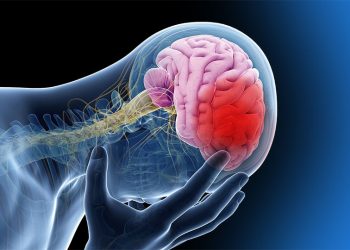 Salud: Cómo detectar un ACV y cómo prevenirlo