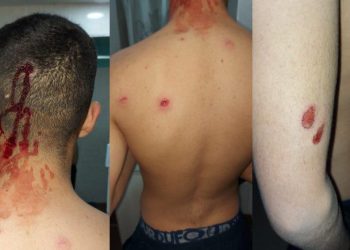 Rincón de los Sauces: Denunció que la policía baleó a su hijo sin razones
