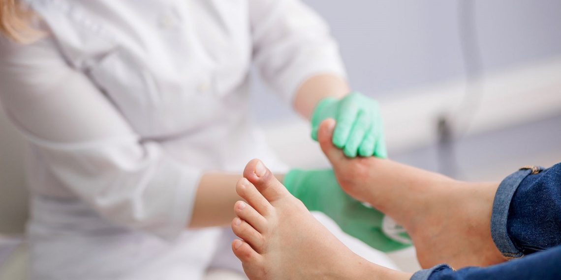 Cutral Co: El cuidado de los pies en pacientes con diabetes es el lema mundial este 2022