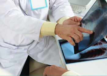 La tuberculosis se puede tratar y curar con un diagnóstico precoz